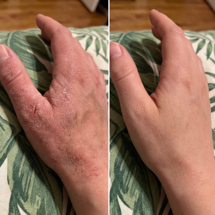 Before and After