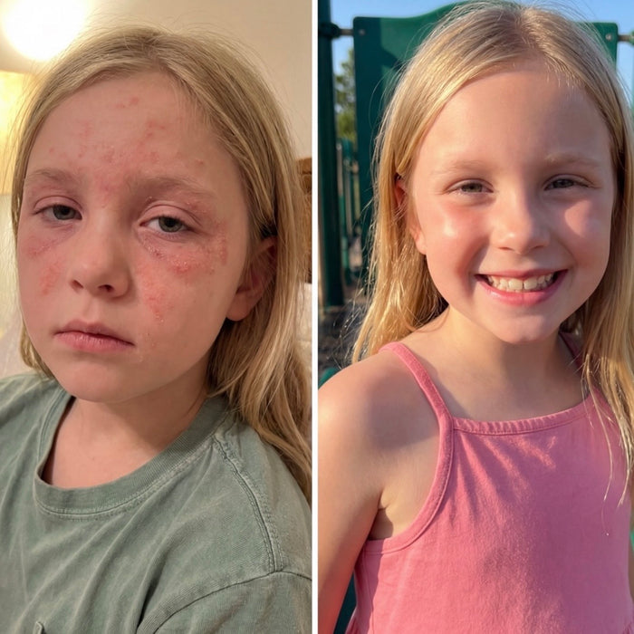 Before and After