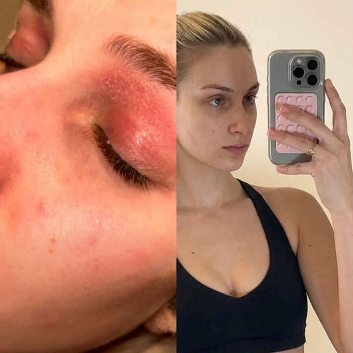 Before and After