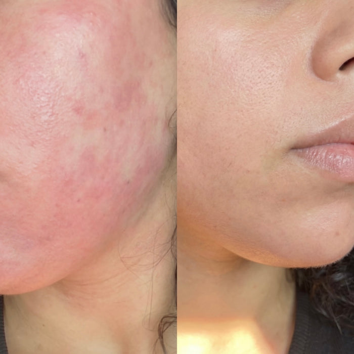 Before and After
