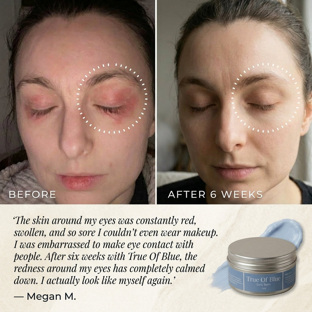 Methylene Blue Daily Balm