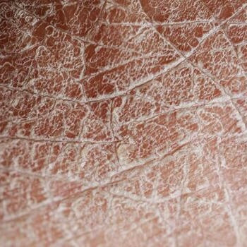 DEHYDRATED SKIN