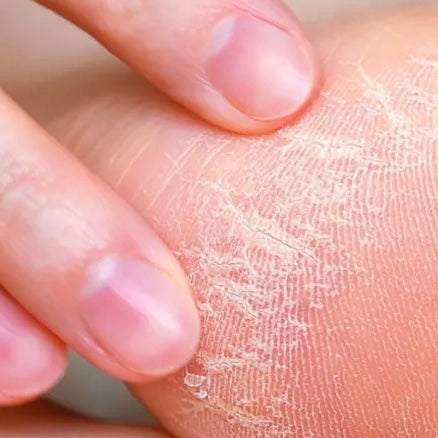 HAND AND FOOT CARE