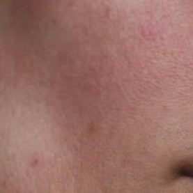 DULL / TIRED LOOKING SKIN