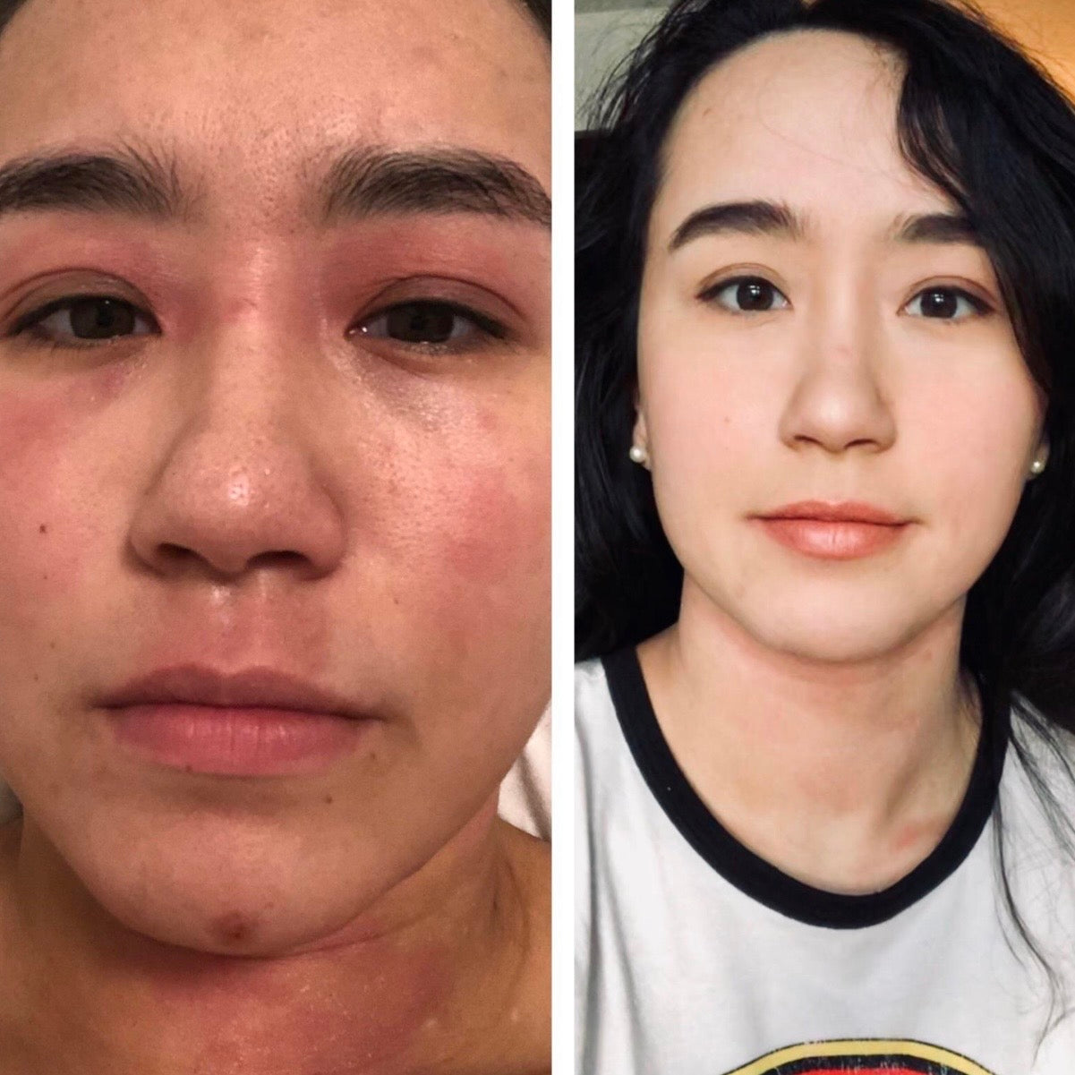 TrueOfBlue™ Daily Balm