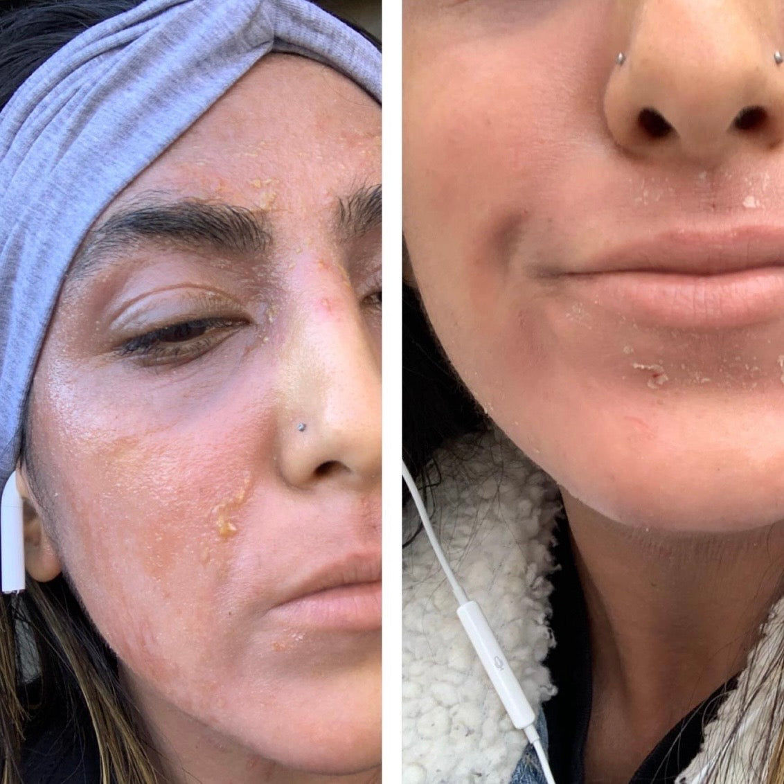 TrueOfBlue™ Daily Balm