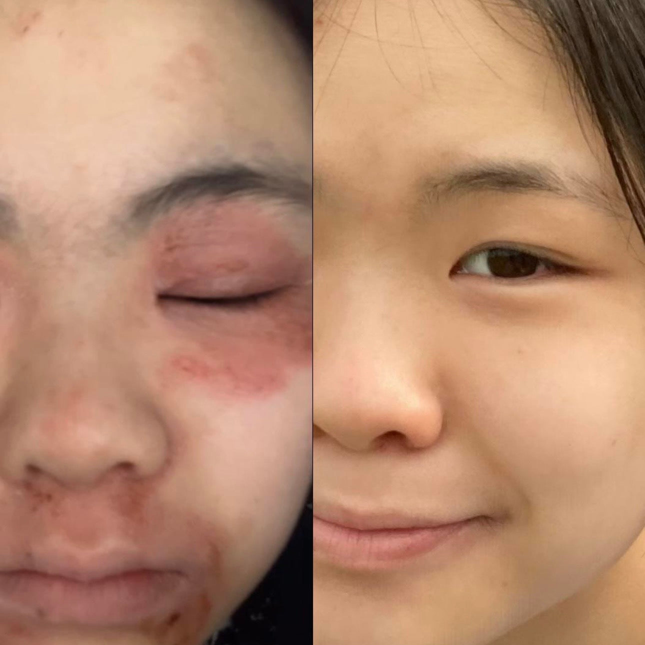 TrueOfBlue™ Daily Balm