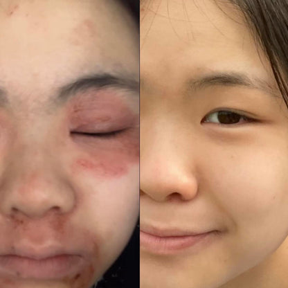 TrueOfBlue™ Daily Balm