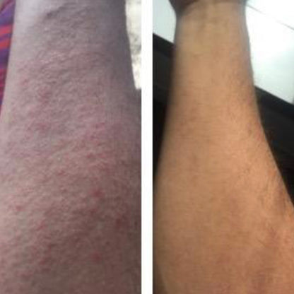 TrueOfBlue™ Daily Balm