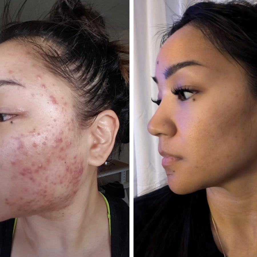 TrueOfBlue™ Daily Balm