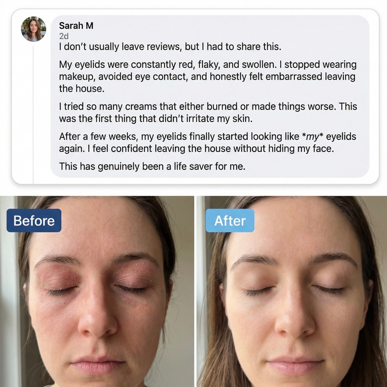 TrueOfBlue™ Methylene Blue Daily Balm