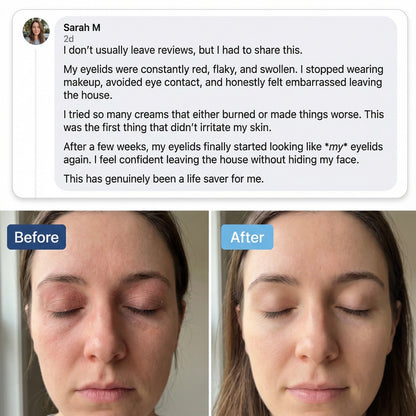 TrueOfBlue™ Methylene Blue Daily Balm