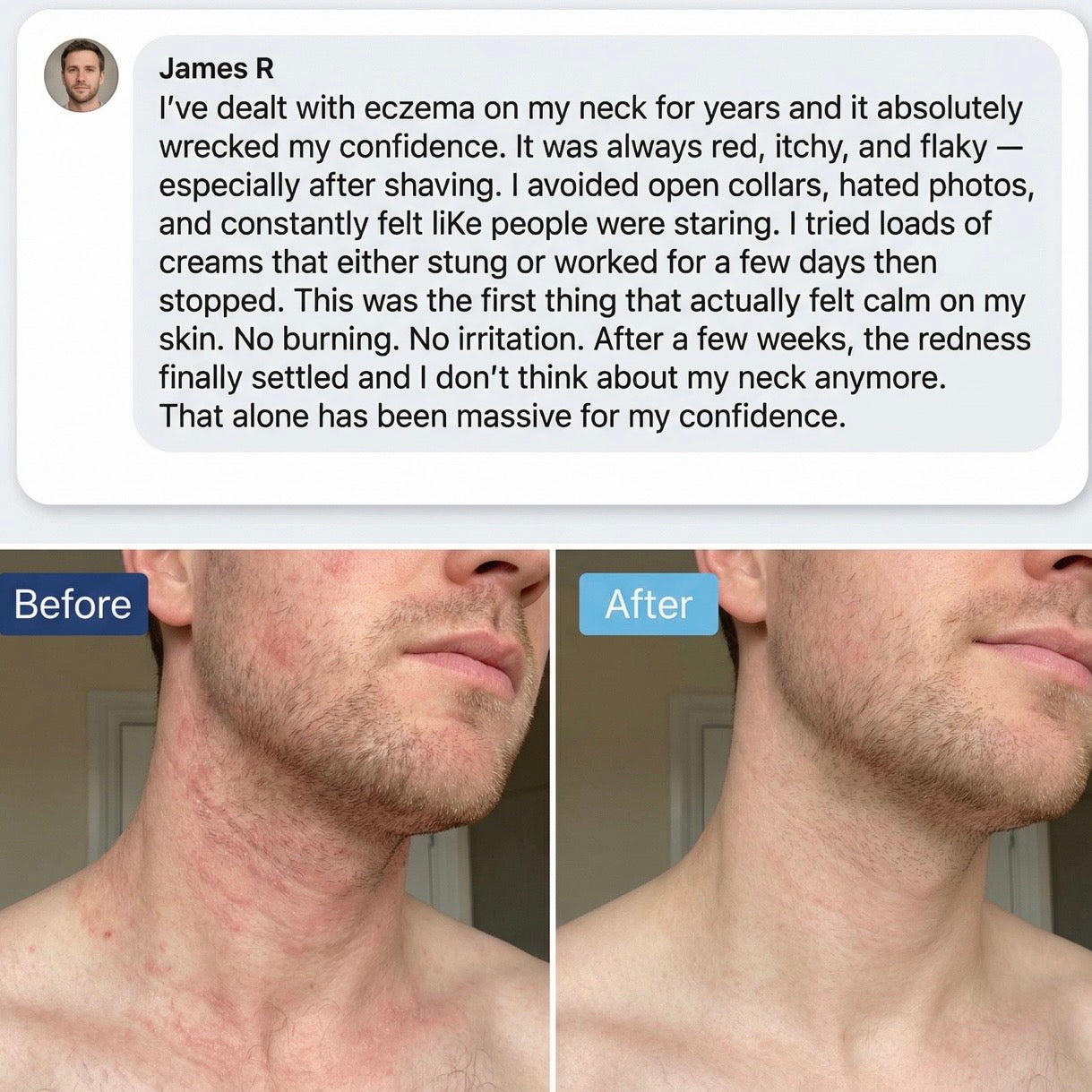 TrueOfBlue™ Methylene Blue Daily Balm