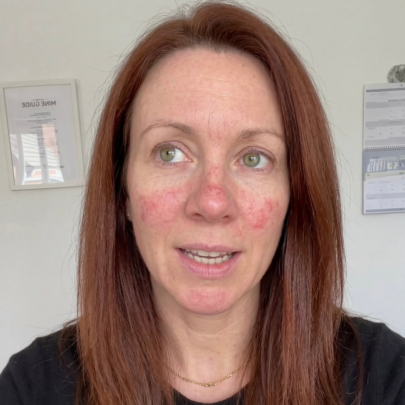 Face Skin Is Biologically Thinner — And That Changes Everything