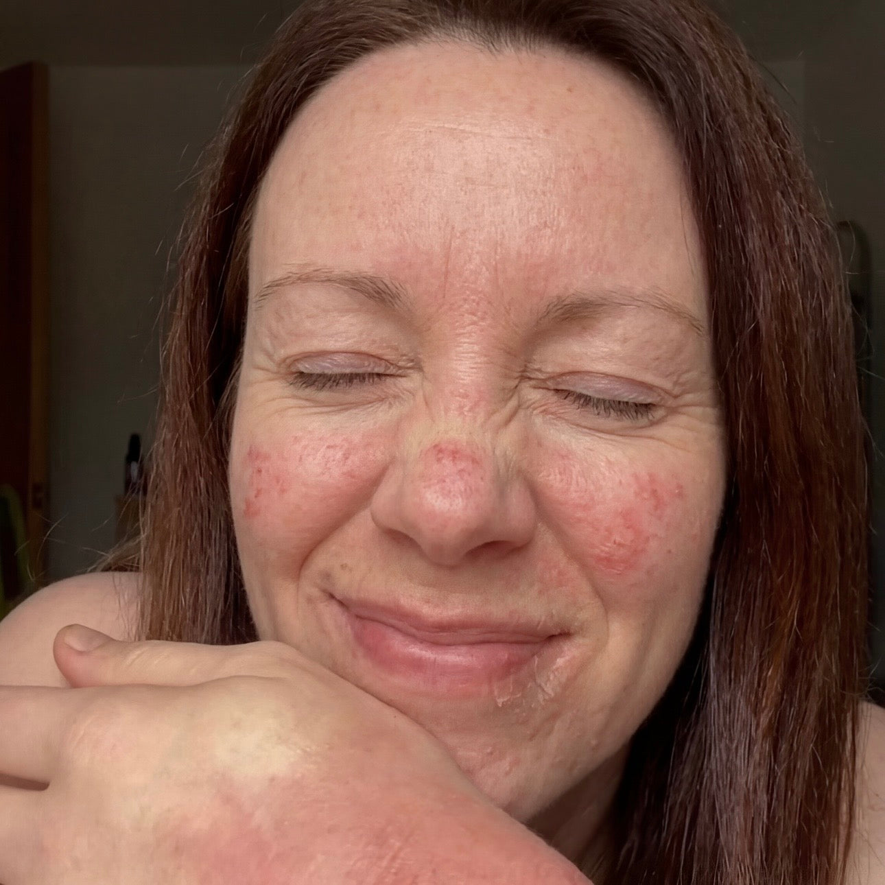 Most Creams Only Hydrate The Surface — They Don't Reach Where The Problem Is