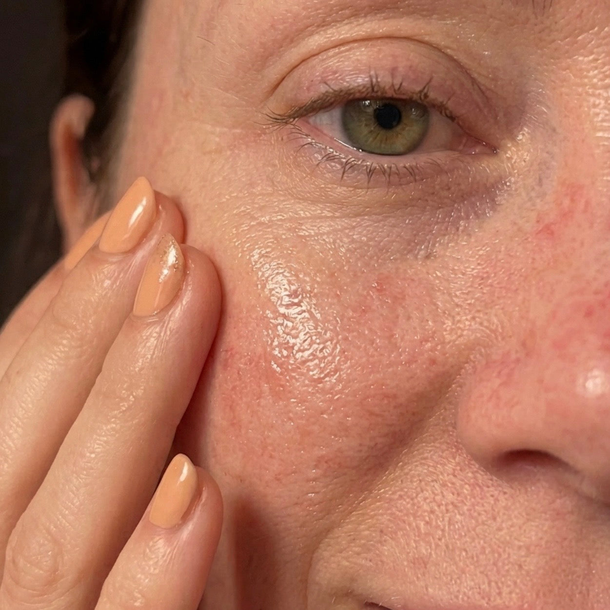 Oxidative Stress Is Draining Your Skin Cells Of The Energy They Need To Repair