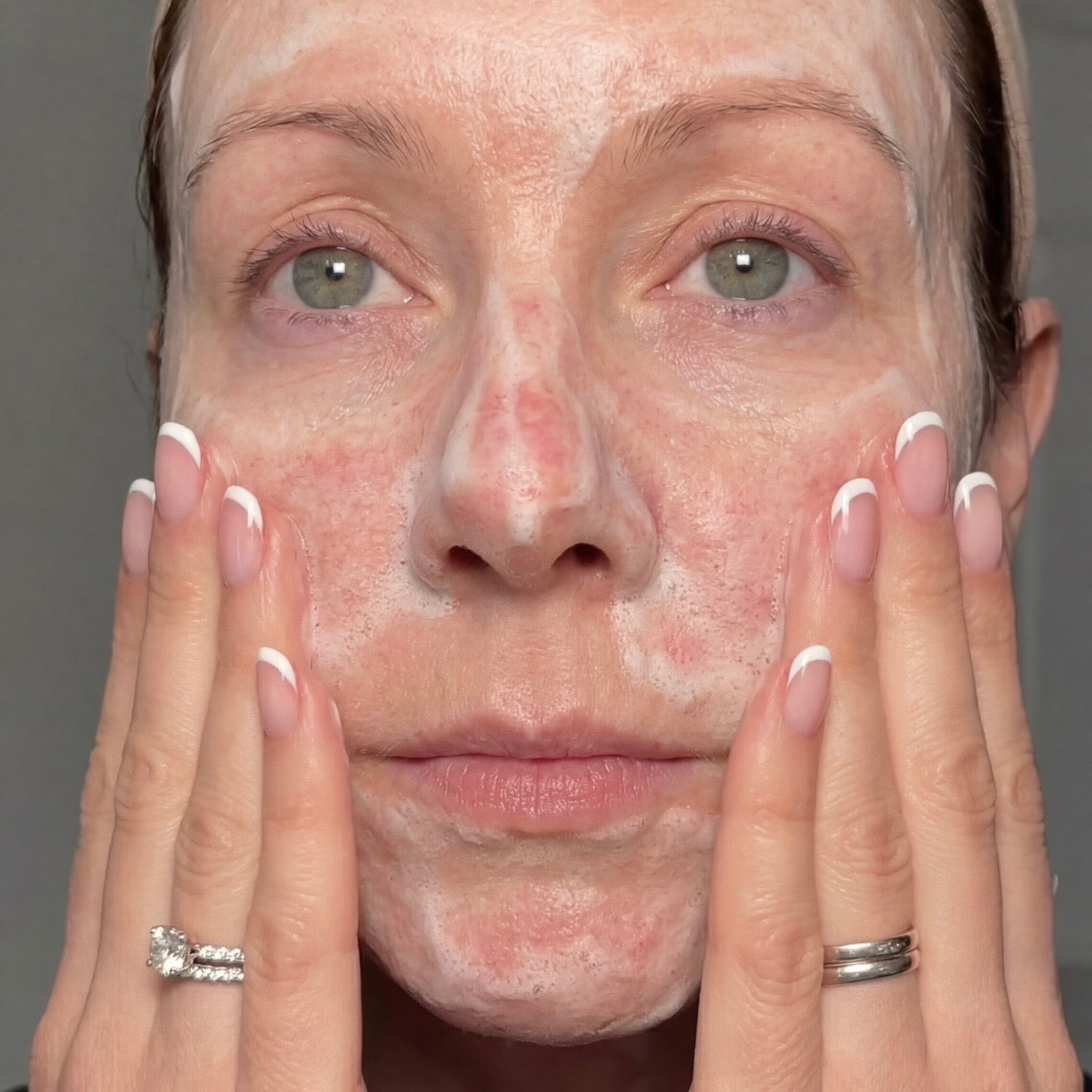 Over-Cleansing Is Silently Stripping The Barrier You're Trying To Rebuild