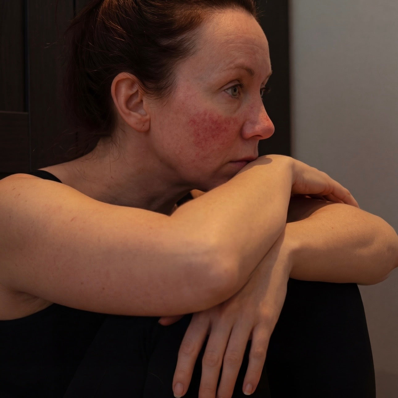 Micro-Cracks In The Barrier Are The Entry Point For Everything That Makes It Worse