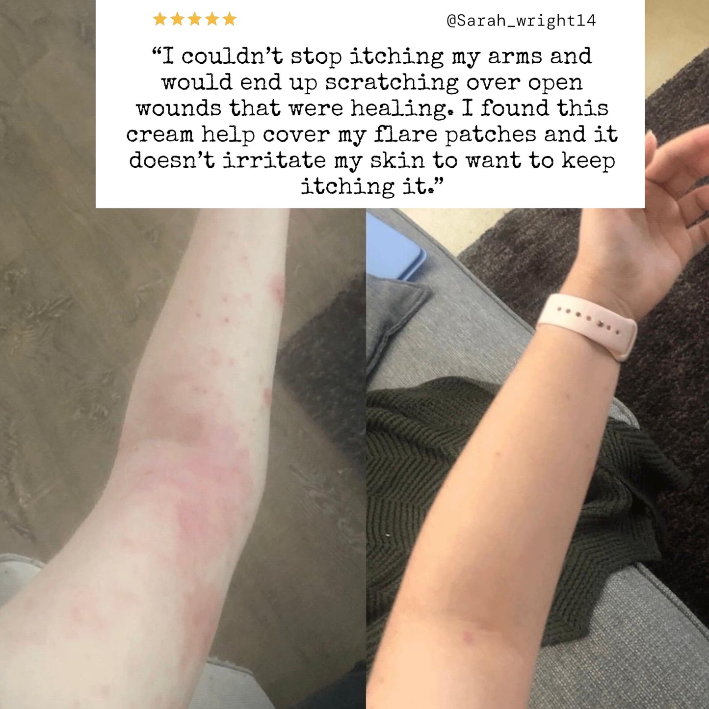 TrueOfBlue™ Daily Balm