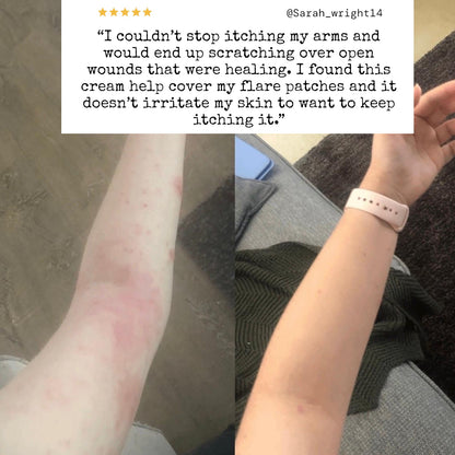 TrueOfBlue™ Daily Balm