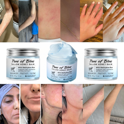 TrueOfBlue™ Daily Balm