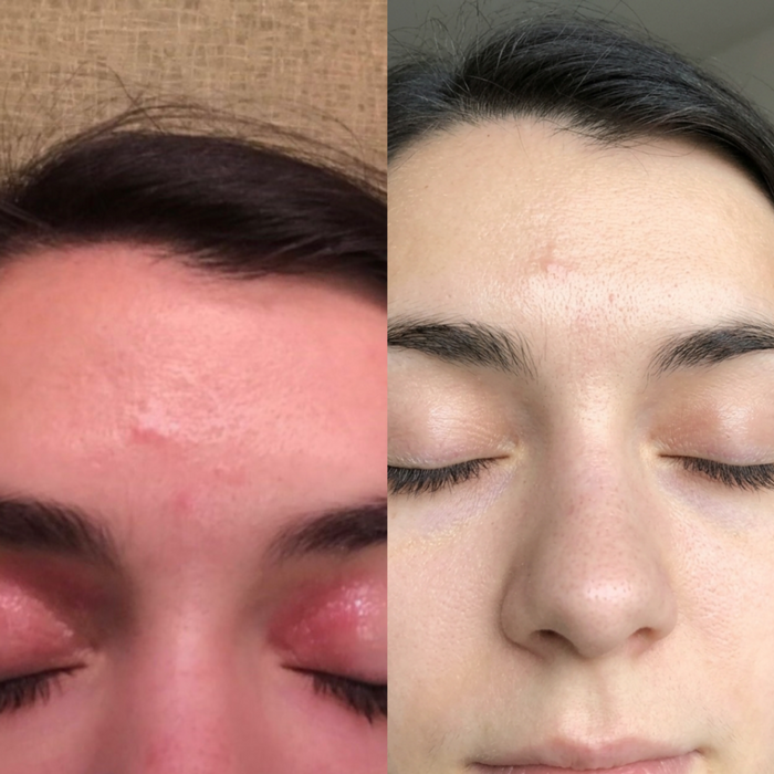 Before and After