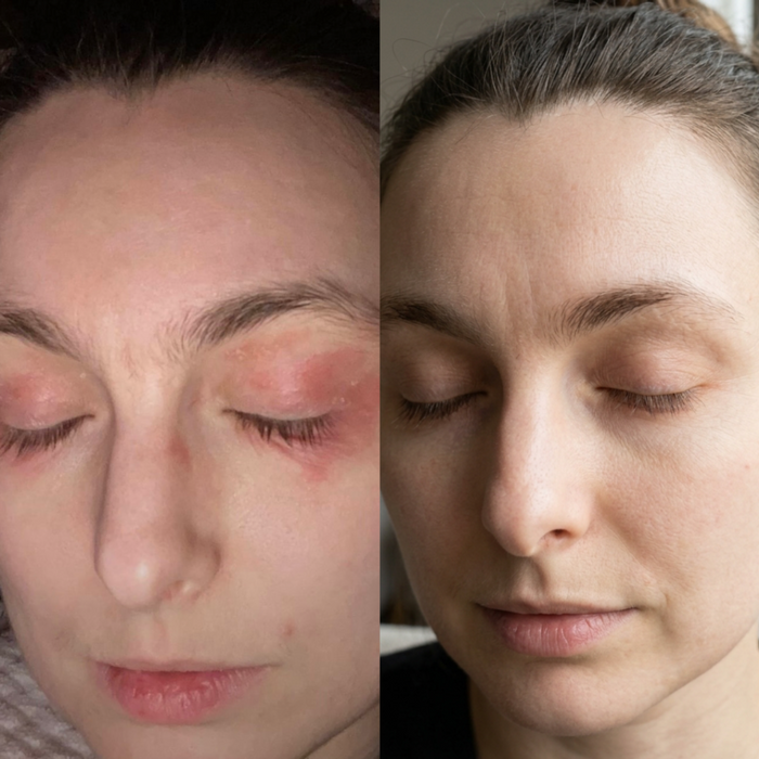 Before and After